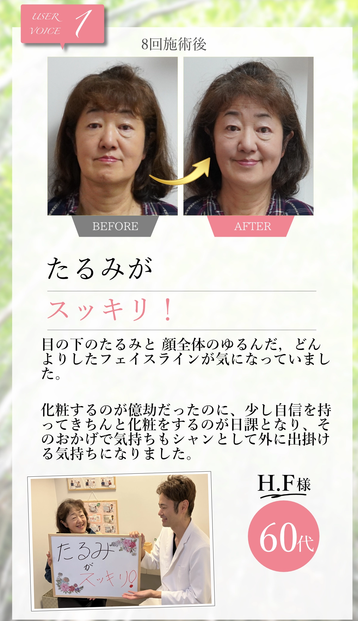 美容鍼8回施術後のビフォーアフター｜60代H.F様の目の下のたるみとフェイスラインが改善した症例写真